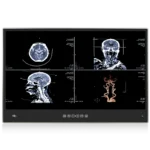 Медицинский панельный ПК POCi-W22C-ULT5-i5/PC/4G