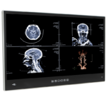 Медицинский панельный ПК POCi-W22C-ULT5-i7/PC/4G